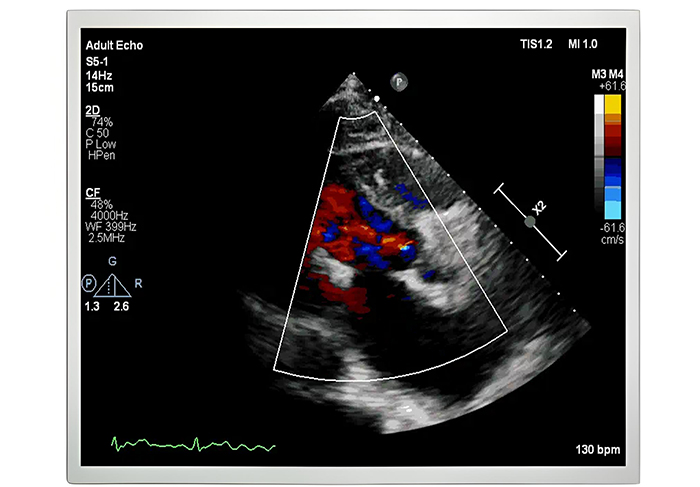 EV190E0M-N50 19寸医疗屏